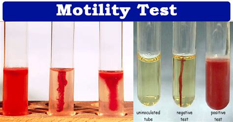 Motility Test Medium Protocol 